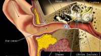 Infeksi Telinga dan Alat Bantu Dengar