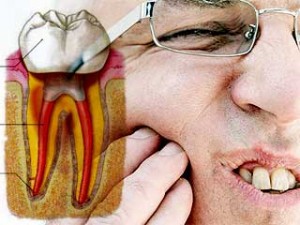 Cara Merawat Gigi Berlubang Agar Tidak Sakit