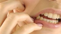 Obat Tradisional Sakit Gigi Paling Manjur