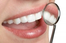Tips dan Cara Alami Mengatasi Karang Gigi 
