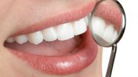 Tips dan Cara Alami Mengatasi Karang Gigi