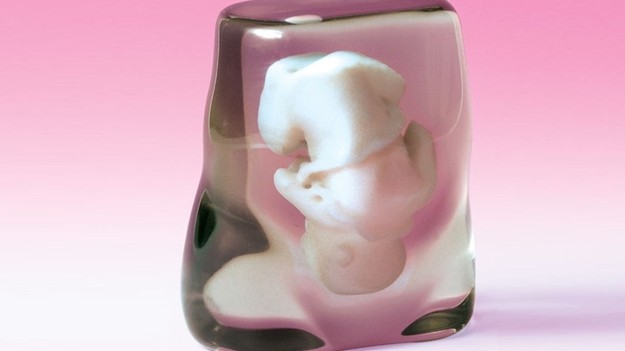 Mengintip Wajah Calon Bayi dalam Rahim dengan Teknologi Printer 3 Dimensi