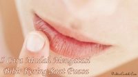 5 Cara Mudah Mengatasi Bibir Kering Saat Puasa