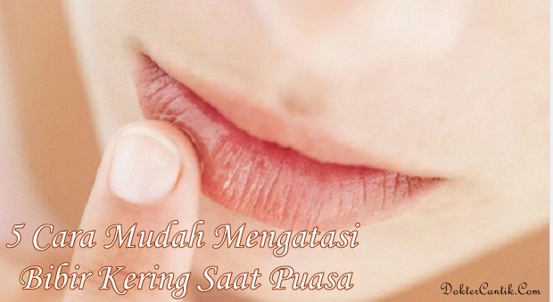 5 Cara Mudah Mengatasi Bibir Kering Saat Puasa
