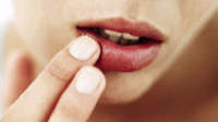 Tips Mencegah Bibir Kering dan Pecah-Pecah