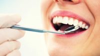 8 Cara Untuk Menghilangkan Karang Gigi