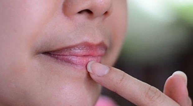 Kenali 14 Penyebab Bibir Menjadi Gelap