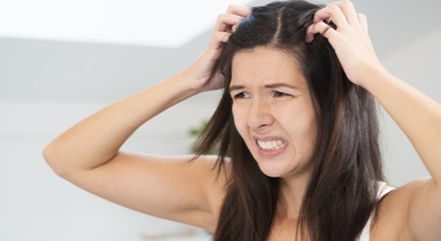 Penyebab Utama Rambut Gatal dan Cara Mengatasinya