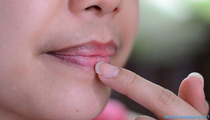 Penyebab Bibir Hitam dan Cara Menanganinya